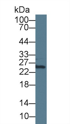 Polyclonal Antibody to Signal Recognition Particle Receptor B (SRPRB)