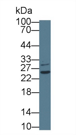 Polyclonal Antibody to Signal Recognition Particle Receptor B (SRPRB)