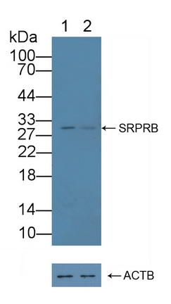 Polyclonal Antibody to Signal Recognition Particle Receptor B (SRPRB)