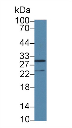 Polyclonal Antibody to Signal Recognition Particle Receptor B (SRPRB)