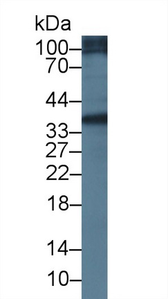 Polyclonal Antibody to Signal Sequence Receptor Alpha (SSRa)