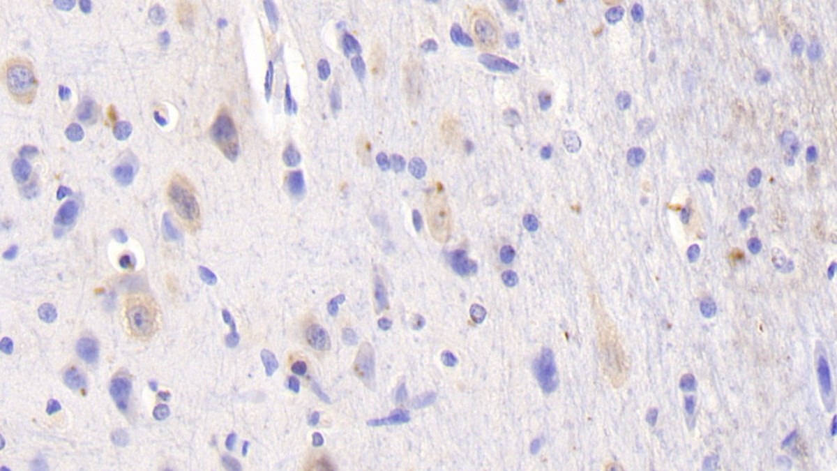 Polyclonal Antibody to Signal Sequence Receptor Alpha (SSRa)