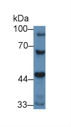 Polyclonal Antibody to Stromal Interaction Molecule 1 (STIM1)