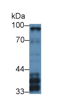 Polyclonal Antibody to Stromal Interaction Molecule 1 (STIM1)