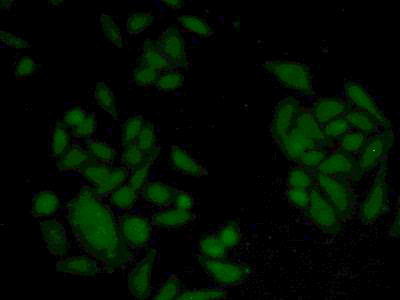 Polyclonal Antibody to Stromal Interaction Molecule 1 (STIM1)