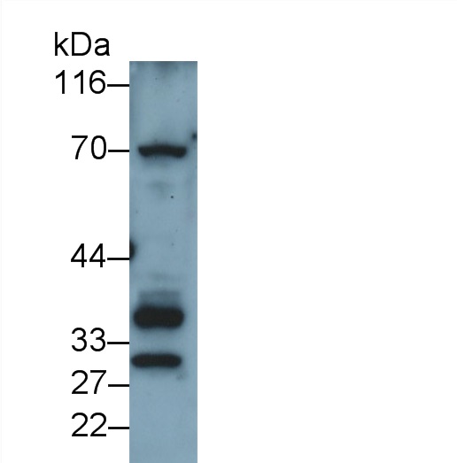 Polyclonal Antibody to Sulfatase Modifying Factor 1 (SUMF1)