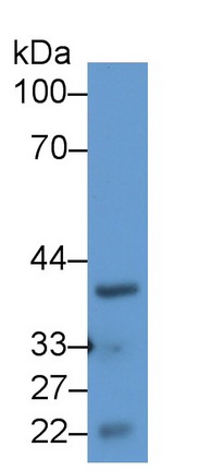 Polyclonal Antibody to Surfeit 1 (SURF1)