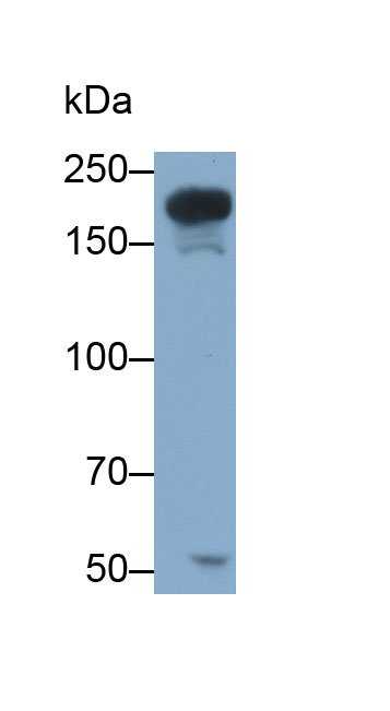 Polyclonal Antibody to Supervillin (SVIL)