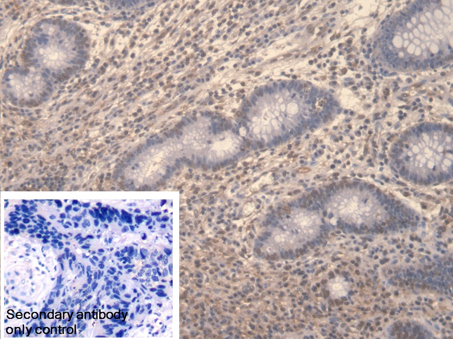 Polyclonal Antibody to Symplekin (SYMPK)