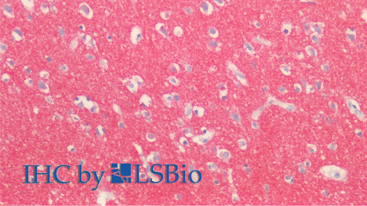 Polyclonal Antibody to Synapsin I (SYN1)