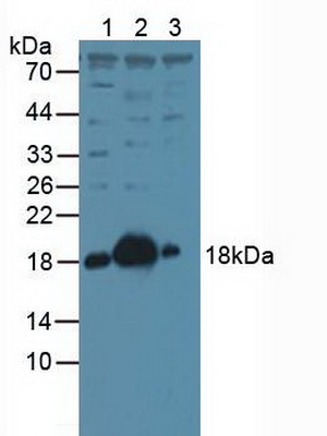 Polyclonal Antibody to Stathmin 1 (STMN1)