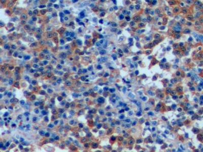 Polyclonal Antibody to Stathmin 1 (STMN1)