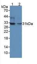 Polyclonal Antibody to Deiodinase, Iodothyronine, Type II (DIO2)