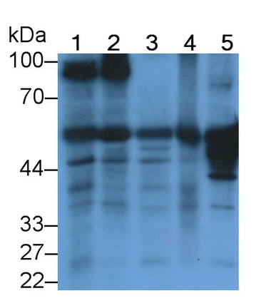 Polyclonal Antibody to Glutamate Decarboxylase 1, Brain (GAD1)