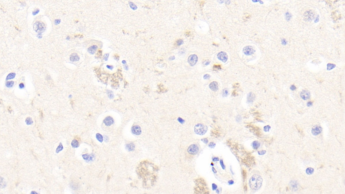 Polyclonal Antibody to Reticulon 1 (RTN1)