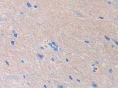 Polyclonal Antibody to Fibroblast Growth Factor 13 (FGF13)