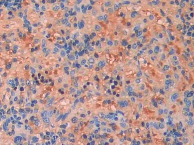 Polyclonal Antibody to Fibroblast Growth Factor 13 (FGF13)