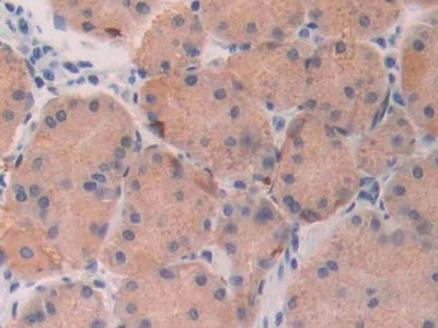 Polyclonal Antibody to Fibroblast Growth Factor 19 (FGF19)