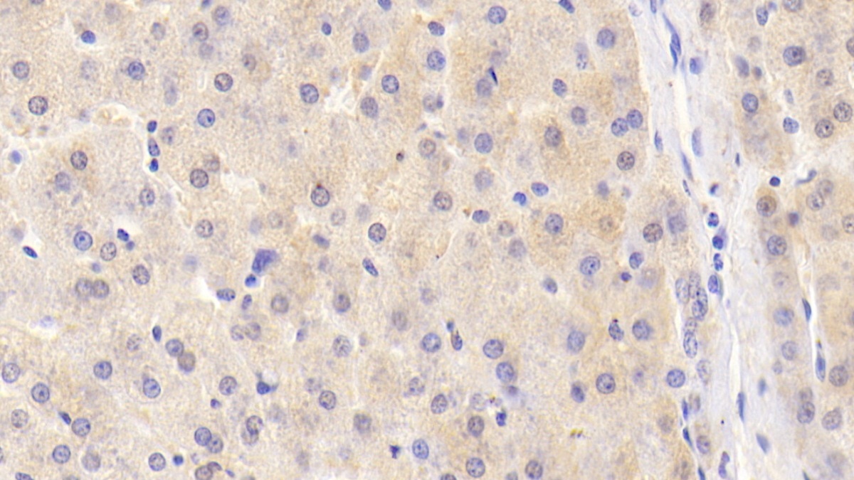 Polyclonal Antibody to Fibroblast Growth Factor 21 (FGF21)