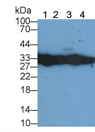 Polyclonal Antibody to Platelet Derived Growth Factor Subunit B (PDGFB)