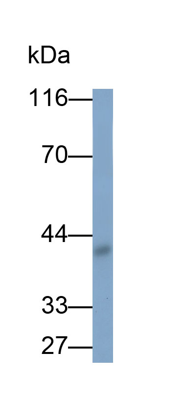 Polyclonal Antibody to Sphingosine 1 Phosphate Receptor 1 (S1PR1)