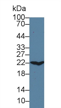 Polyclonal Antibody to Crystallin Alpha B (CRYaB)