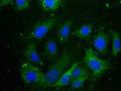 Polyclonal Antibody to Crystallin Alpha B (CRYaB)