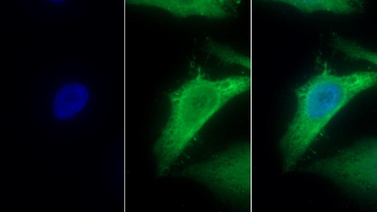 Polyclonal Antibody to Melatonin Receptor 1A (MTNR1A)