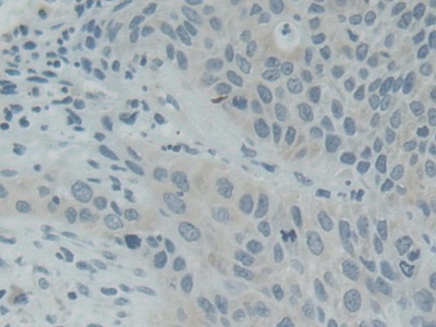 Polyclonal Antibody to Synaptosomal Associated Protein 25kDa (SNAP25)