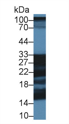 Polyclonal Antibody to Synaptosomal Associated Protein 25kDa (SNAP25)