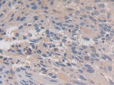 Polyclonal Antibody to Calpain 3 (CAPN3)