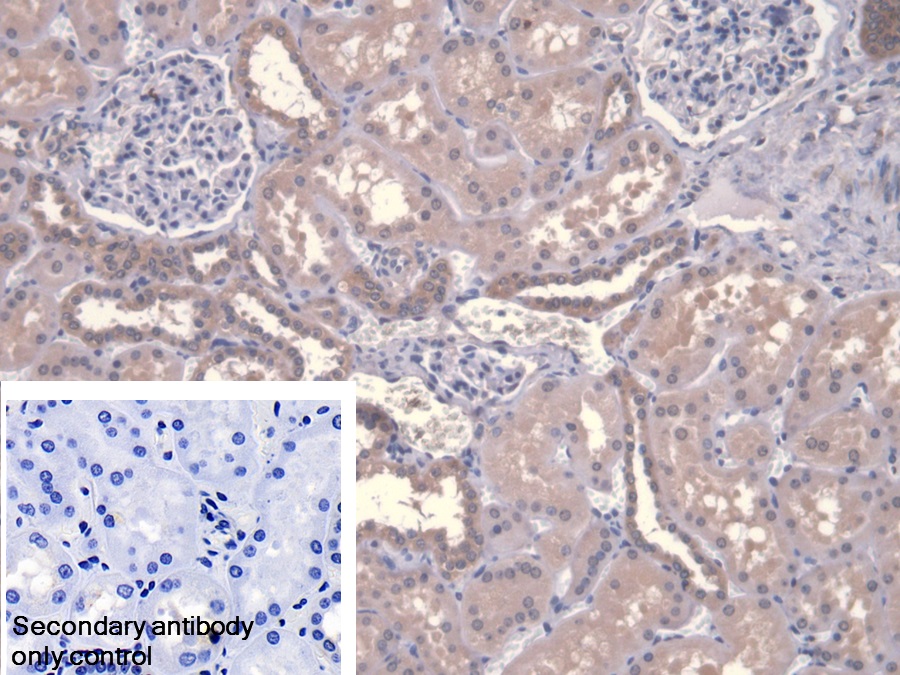 Polyclonal Antibody to Calpain 9 (CAPN9)