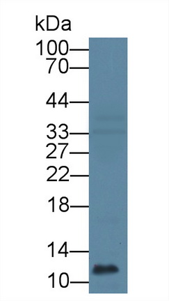 Polyclonal Antibody to Cathepsin C (CTSC)