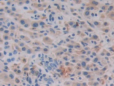 Polyclonal Antibody to Cathepsin C (CTSC)