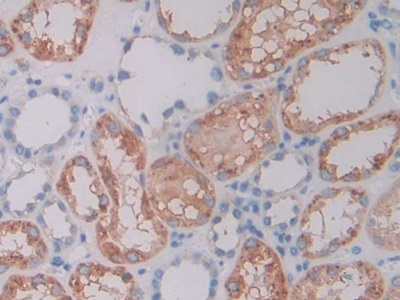 Polyclonal Antibody to Cathepsin C (CTSC)