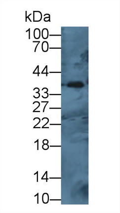 Polyclonal Antibody to Cathepsin H (CTSH)