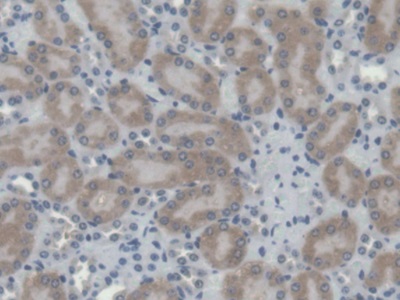 Polyclonal Antibody to Cathepsin H (CTSH)