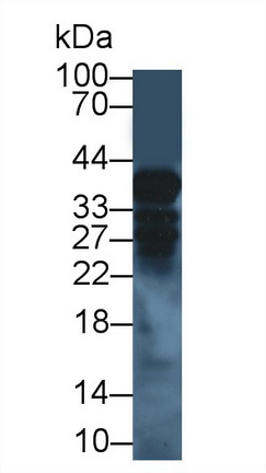 Polyclonal Antibody to Cathepsin H (CTSH)