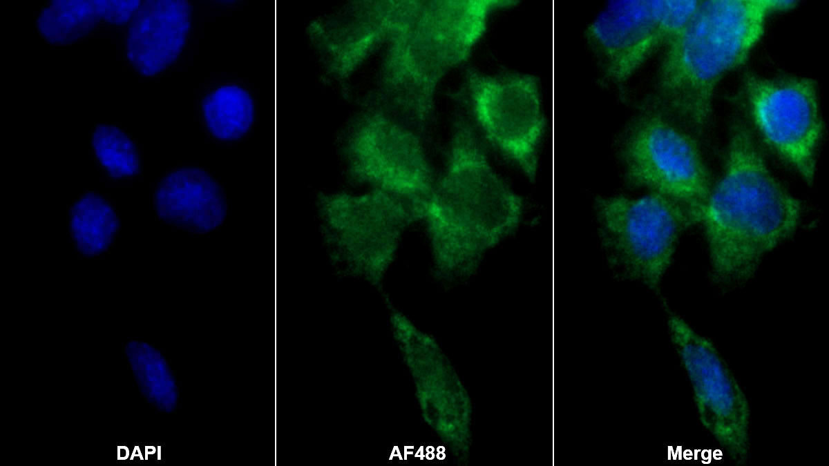 Polyclonal Antibody to Cathepsin H (CTSH)