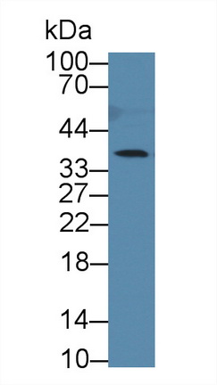 Polyclonal Antibody to Cathepsin Z (CTSZ)