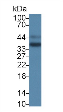 Polyclonal Antibody to Cathepsin Z (CTSZ)