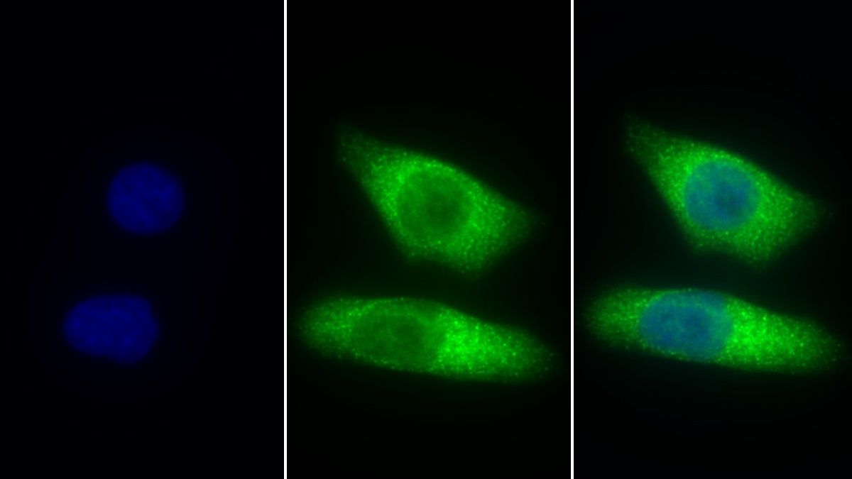 Polyclonal Antibody to Cathepsin Z (CTSZ)