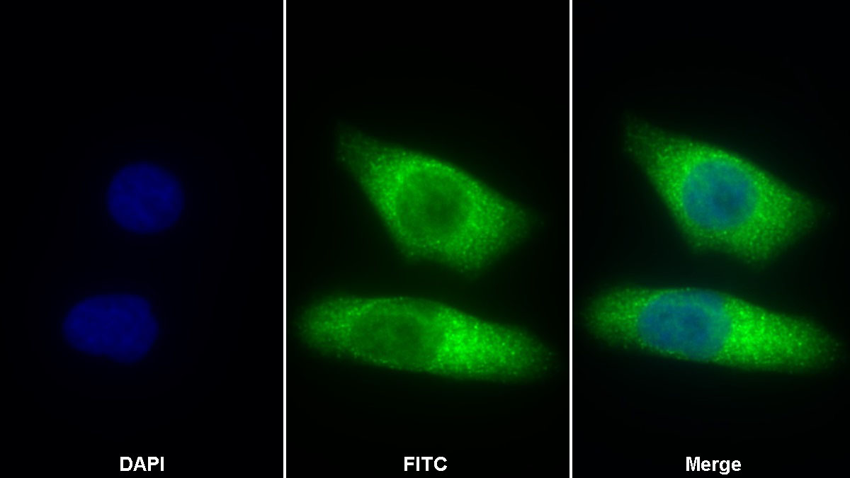 Polyclonal Antibody to Cathepsin Z (CTSZ)