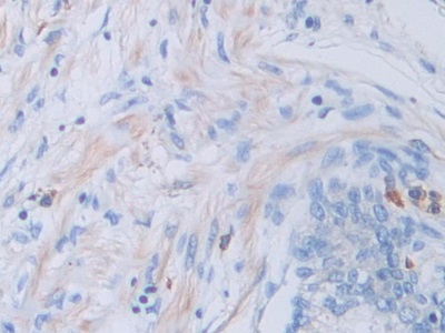 Polyclonal Antibody to Cathepsin V (CTSV)