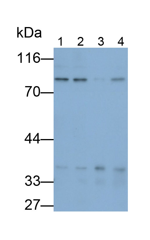 Polyclonal Antibody to Transforming Growth Factor Beta Receptor II (TGFbR2)