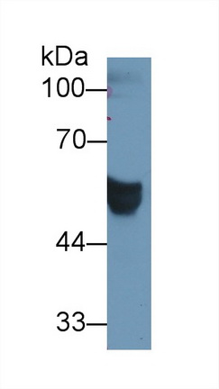 Polyclonal Antibody to Carcinoembryonic Antigen Related Cell Adhesion Molecule 1 (CEACAM1)