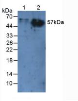 Polyclonal Antibody to Carcinoembryonic Antigen Related Cell Adhesion Molecule 1 (CEACAM1)