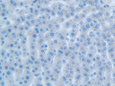 Polyclonal Antibody to Carcinoembryonic Antigen Related Cell Adhesion Molecule 1 (CEACAM1)