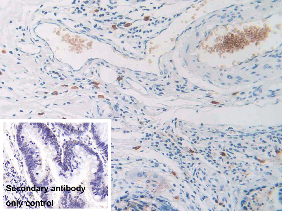 Polyclonal Antibody to Carcinoembryonic Antigen Related Cell Adhesion Molecule 7 (CEACAM7)