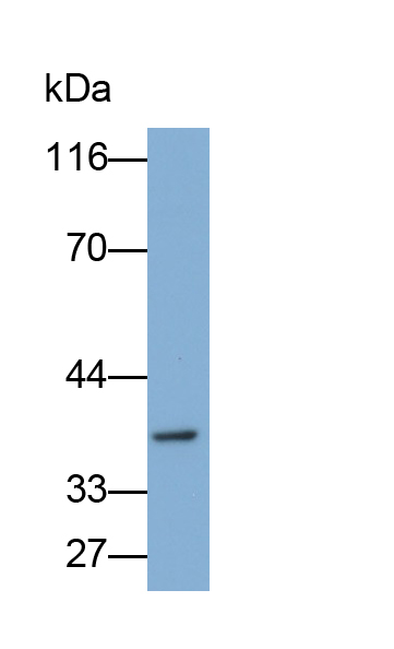 Polyclonal Antibody to Carcinoembryonic Antigen Related Cell Adhesion Molecule 6 (CEACAM6)